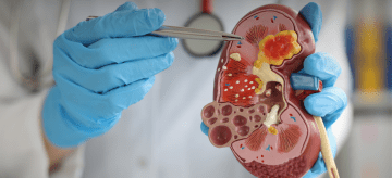 Visite Nefrologiche e Terapie Conservative Dal 1975 siamo vicini alla salute dei Trapanesi